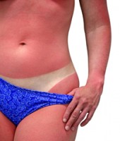 Coup de soleil résumé