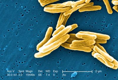 tuberculosis-source