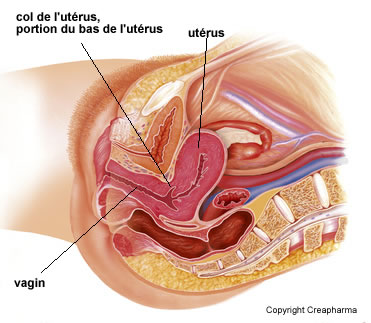 cancer du col de l'utérus introduction