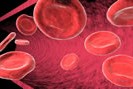 fer Soigner naturellement le syndrome prémenstruel