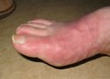 goutte définition