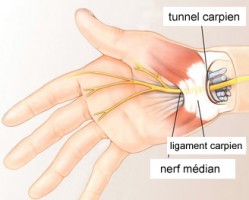 8 problèmes courants qui touchent la main