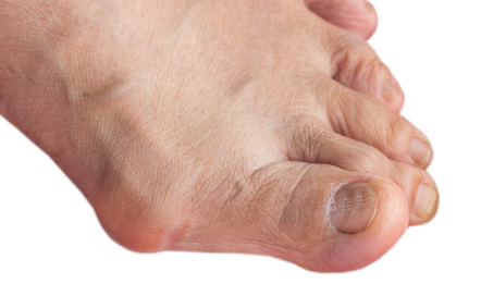 10 Problemes Courants Qui Touchent Le Pied Creapharma