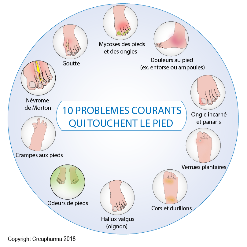 10 Probl mes Courants Qui Touchent Le Pied Creapharma 10 Probl mes Courants Qui Touchent Le Pied Creapharma