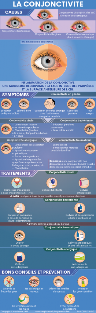 Conjonctivite : causes, symptômes & traitements | Creapharma