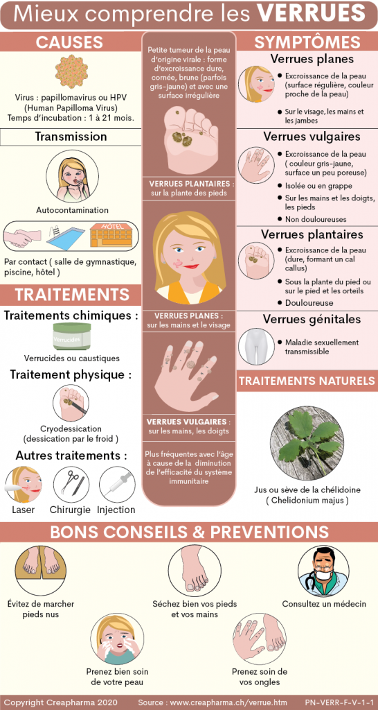 Verrues Causes Sympt mes Traitements Creapharma