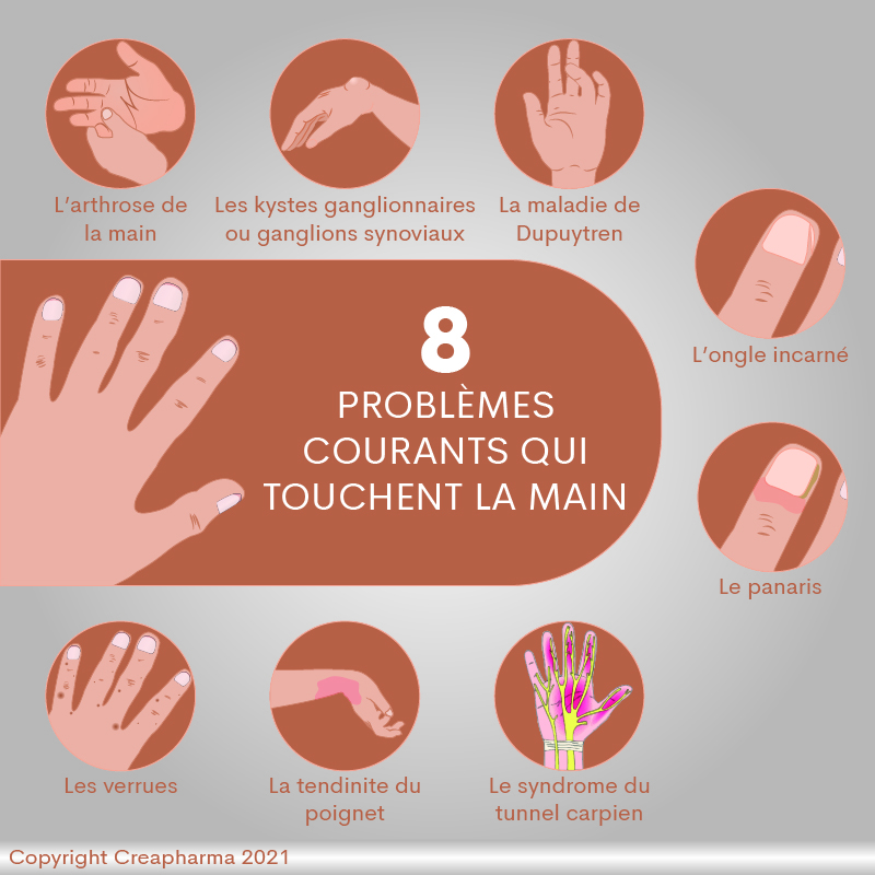 8 problèmes courants qui touchent la main