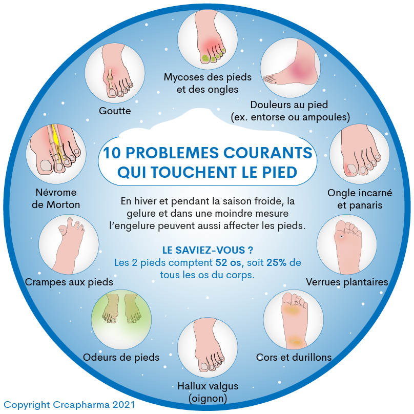 10 problèmes courants qui touchent le pied
