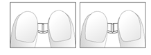 Nebilet image 1