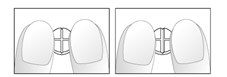Nebilet image 2