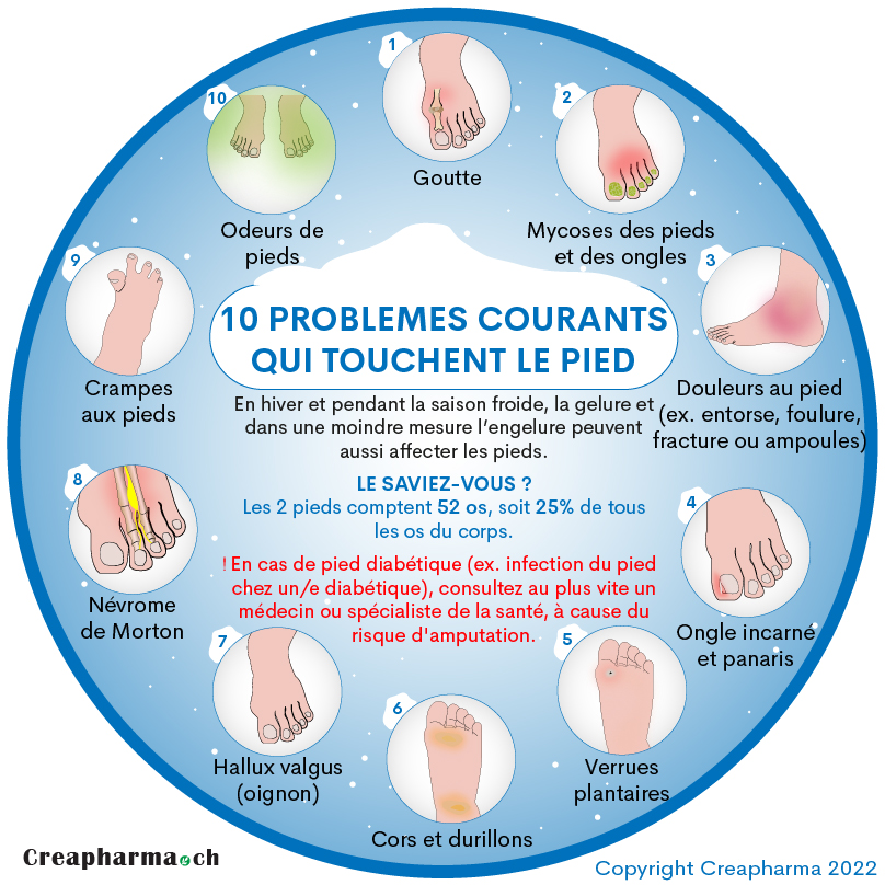 10 problèmes courants qui touchent le pied