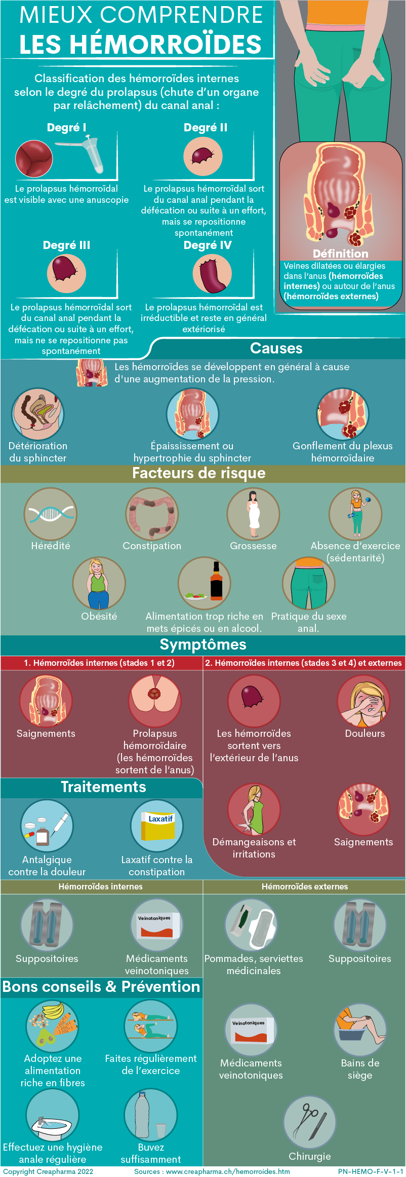 Traitement hémorroïdes : thromboses, saignements et prolapsus  hémorroïdaires - Hôpital Paris Saint Joseph