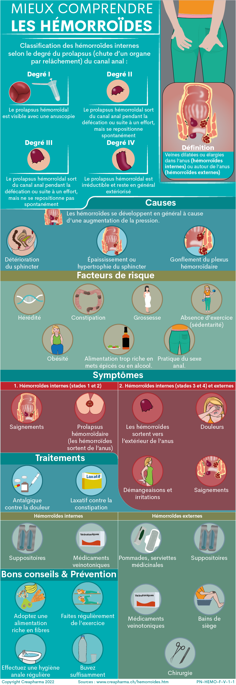 Traitement hémorroïdes : thromboses, saignements et prolapsus  hémorroïdaires - Hôpital Paris Saint Joseph