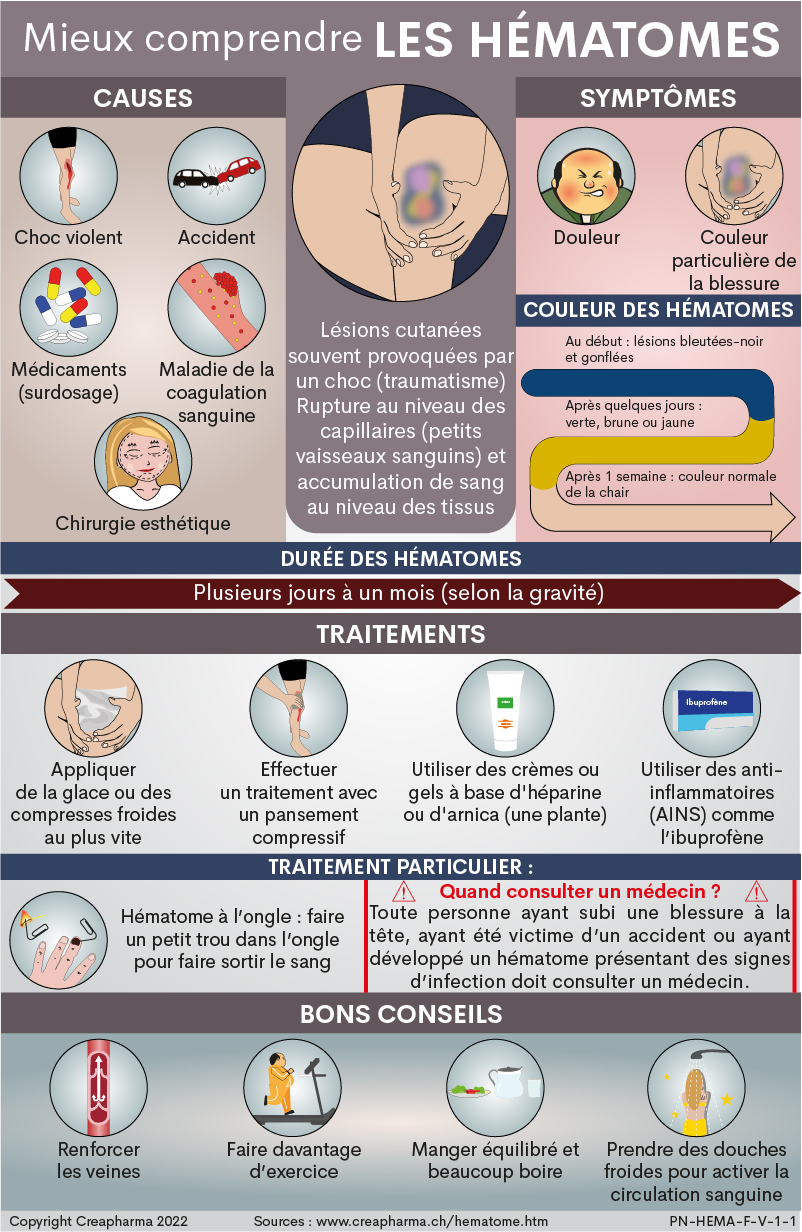 Hématomes : causes, symptômes & traitements | Creapharma