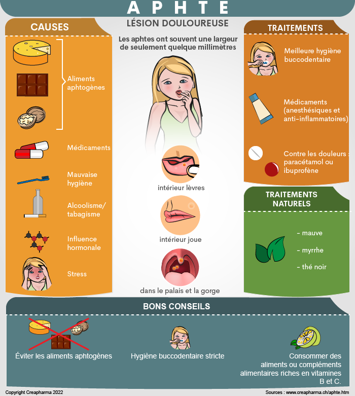 Aphtes : causes, symptômes & traitements | Creapharma