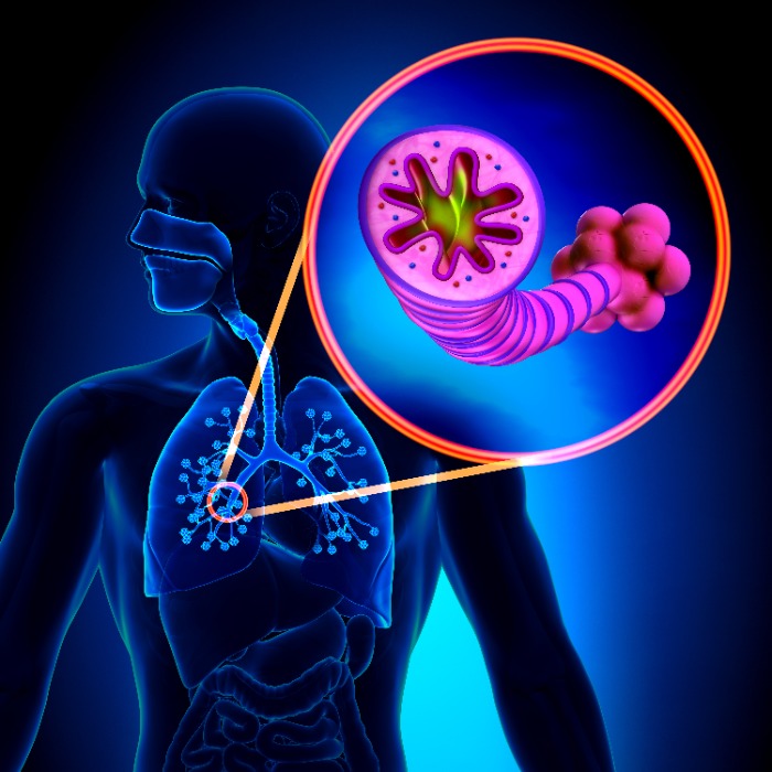 Bronchite : causes, symptômes & traitements