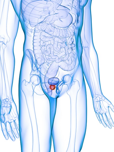 Inflammation prostate