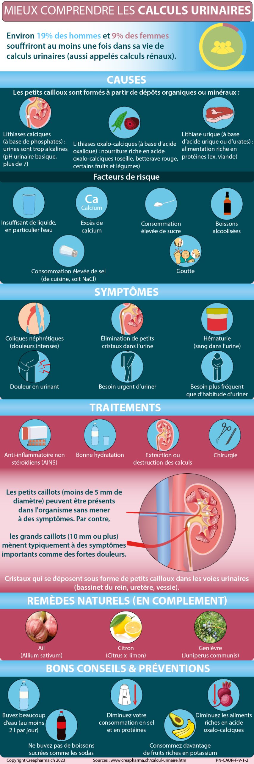 Résumé sur les calculs urinaires